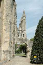 Tourelle avec un escalier en colimaçon qui marquait l'extrémit Tourelle Escalier Abbaye